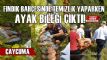 Fndk bahesinde temizlik yaparken ayak bilei kt!